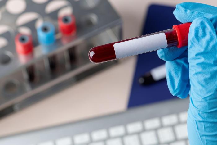 Chronická lymfocytární leukemie: Pacientů přibývá, dožívají se věku i nemocí běžné populace. Jak zajistit kvalitu péče?